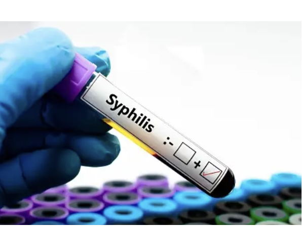 Syphilis cases increase in the Americas